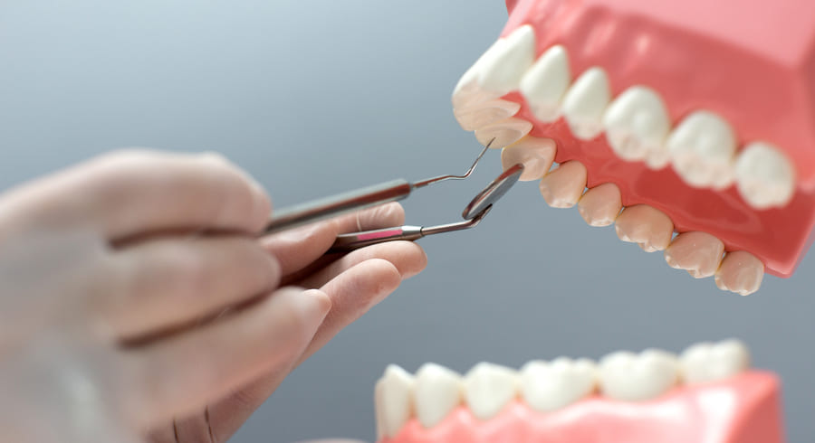 Стоматологи смогут освоить новые методики диагностики и реставрации жевательных зубов - фотография