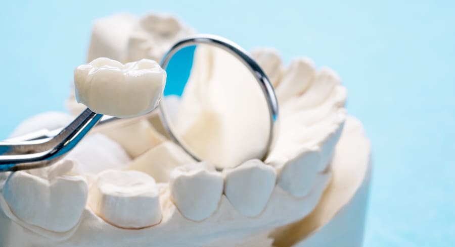 Для стоматологов прошел вебинар по реставрации зубов - фотография