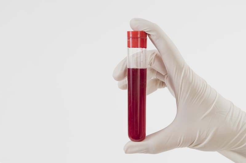 Ученые ищут способ сделать донорскую кровь универсальной - фотография